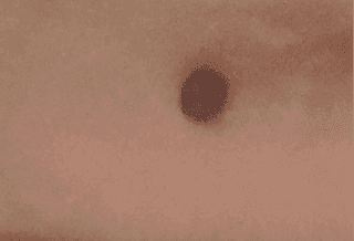 癦
