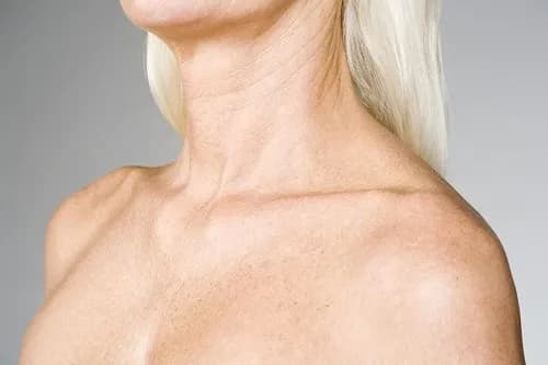 neck lines
