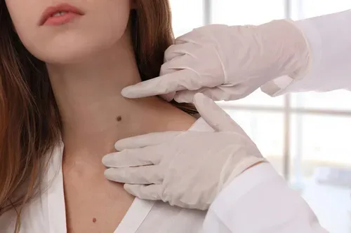 Moles