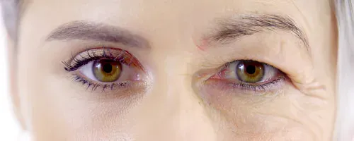 Aging Eye The Process and Its Impact