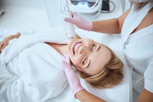 RF microneedling