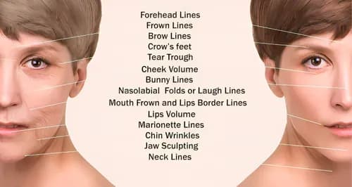 Understanding the Facial Aging by Regions Upper Middle and Lower Thirds
