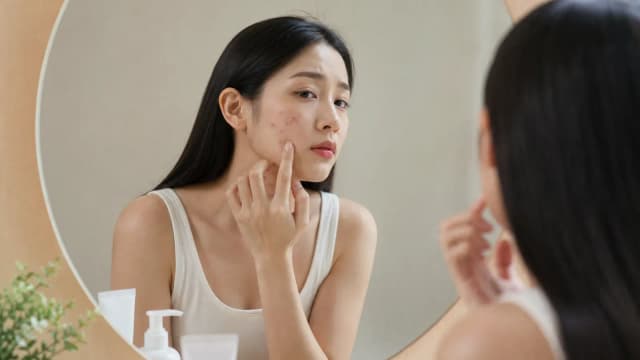 Editorial image for Acne Care Tips: A Doctor’s Guide on How to Effectively Combat Acne
