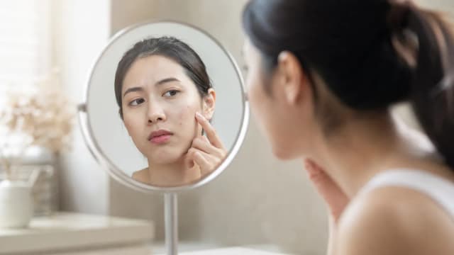 Editorial image for Acne Treatment: The Indelible Journey of Fighting Acne
