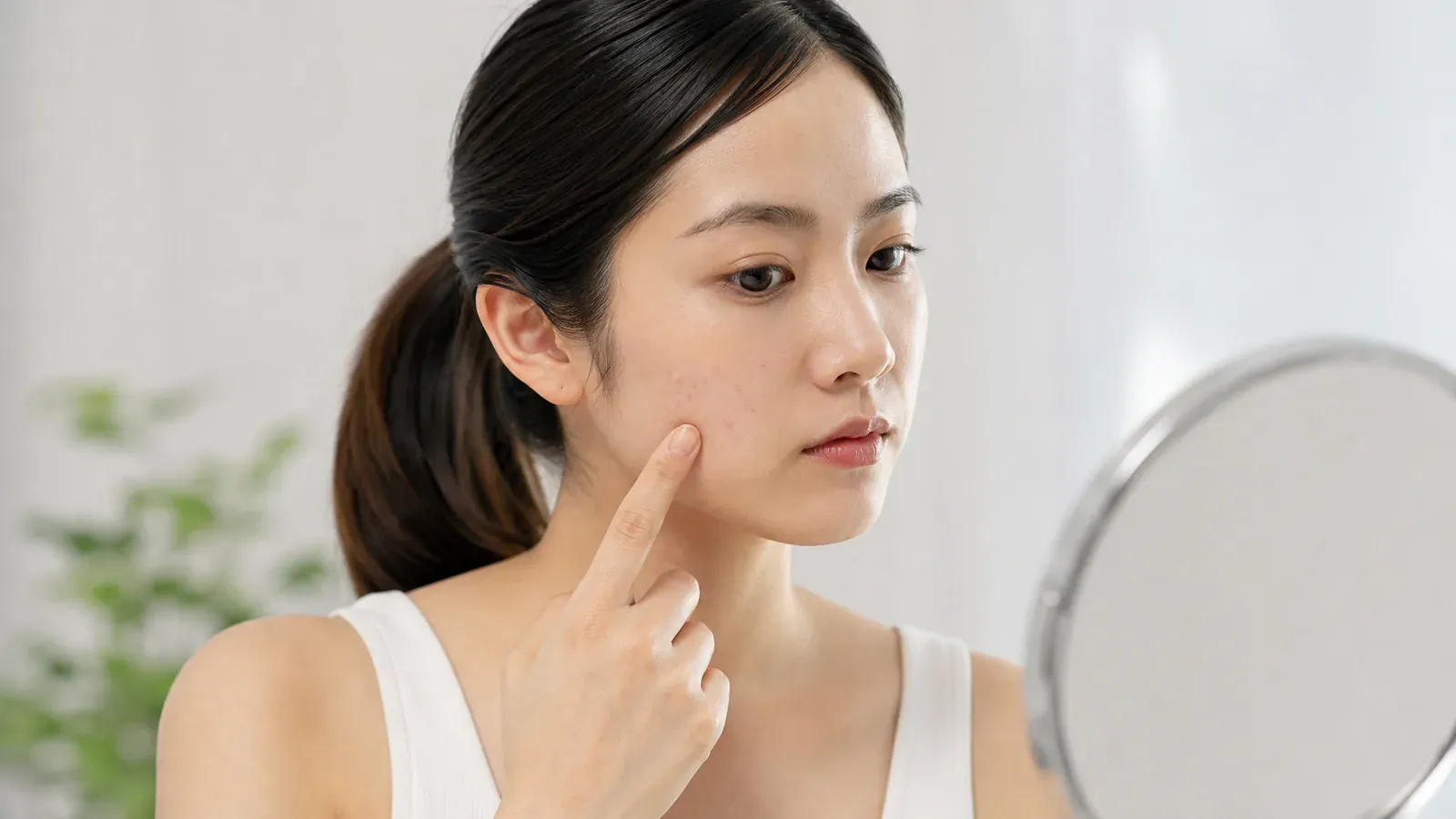“治疗暗疮的必备指南:辨别暗疮与粉刺的关键”的专题图片