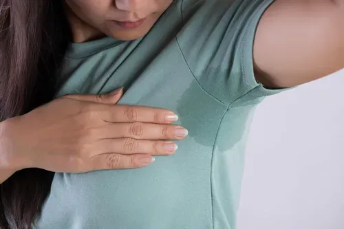 excessive sweating