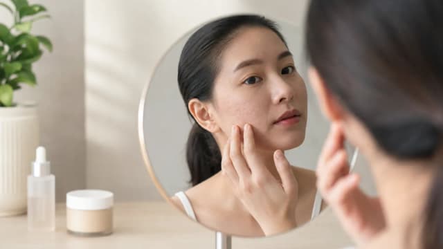 Editorial image for Hope on the Horizon: Effective Topical Solutions for Acne Scars and Empowering Self-Confidence