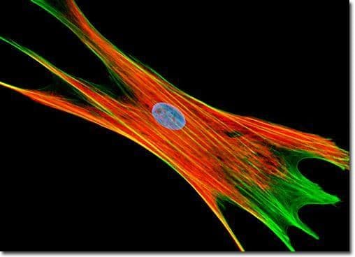 fibroblast