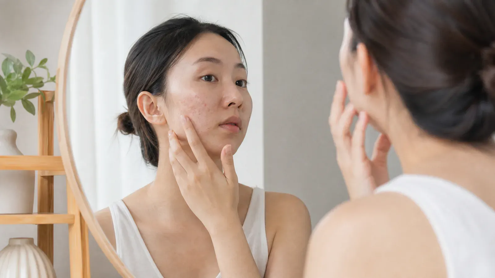 “异维A酸:对其在痤疮治疗中的深入探讨”的专题图片
