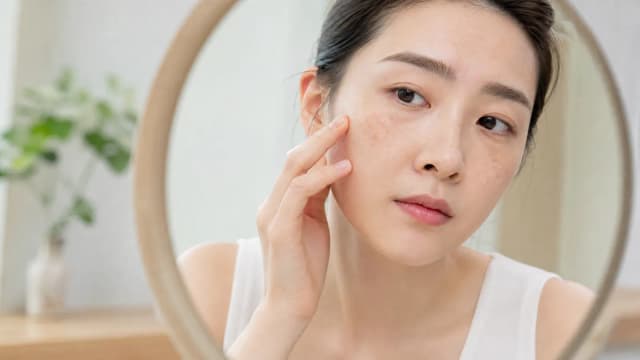 Editorial image for Laser Spot Removal: Understanding Your Spots and Choosing the Right Treatment