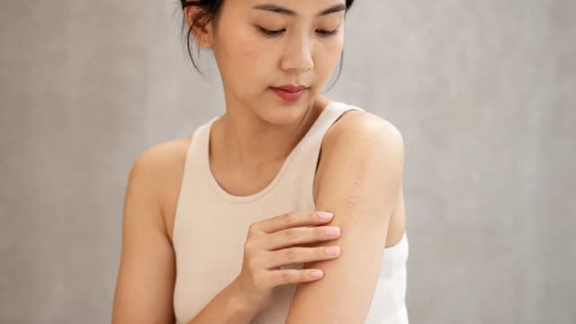 Editorial image for Managing Surgical Scars- Effective Treatments and Interventions