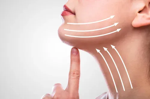 nefertiti lift