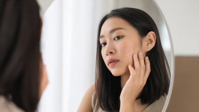 Editorial image for Pico Lasers: A Promising Solution for Acne Scars with Minimal Downtime