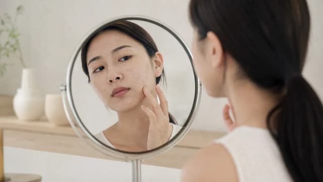 Editorial image for Revolutionizing Acne Scar Treatment: Integrating Isotretinoin and Advanced Revision Techniques