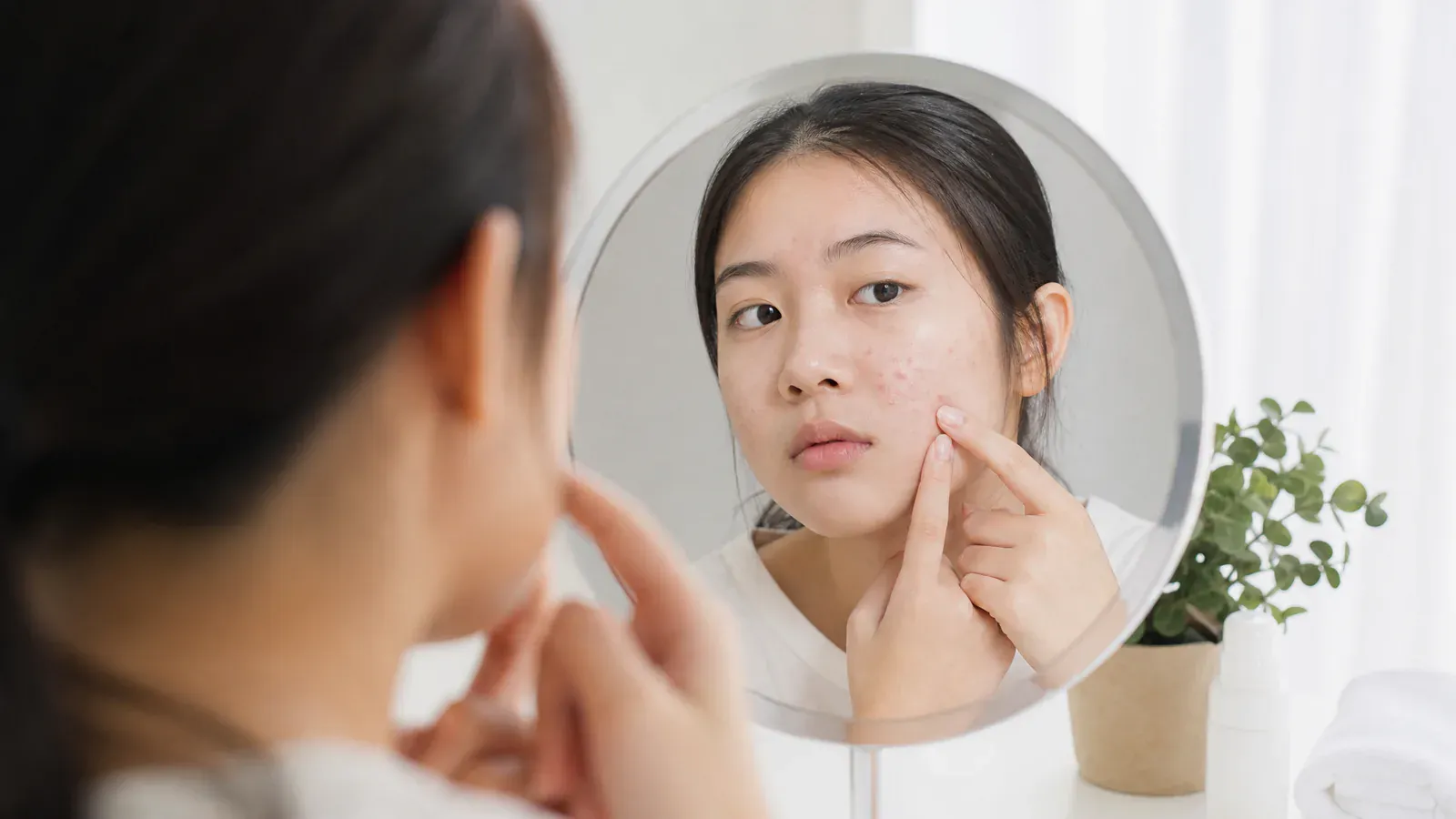 “青春期皮肤保养秘诀:两大关键助你摆脱痘痘烦恼”的专题图片