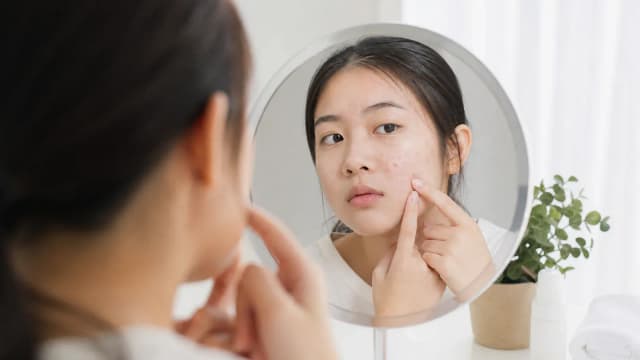 Editorial image for Secrets to Skincare during Puberty: Two Key Tips to Help You Overcome Acne Troubles