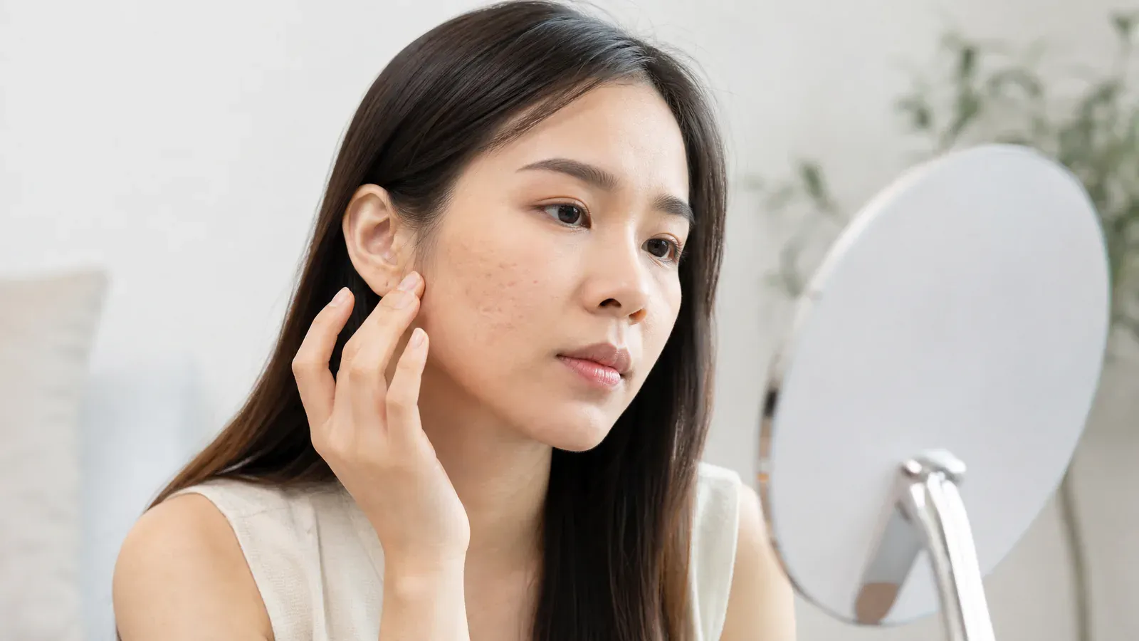 “治疗痘疤的真正考量:你需要注意的四种情况”的专题图片