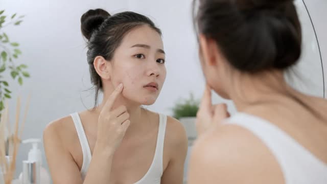 Editorial image for The Truth About Acne: How to Effectively Treat and Prevent Scarring?