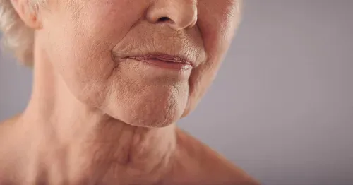 thinning lip