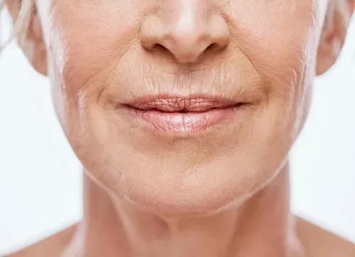 wrinkles