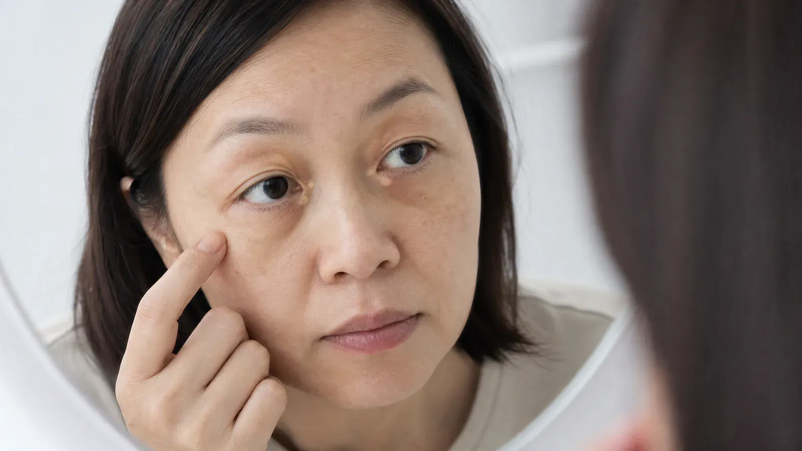 「黃斑瘤:成因、症狀與治療」的專題圖片